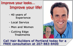 hair-loss-replacement-treatment